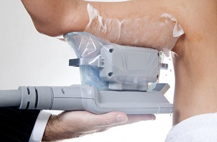fat freezing arms Guildford