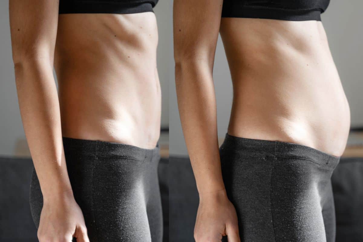How long does diastasis recti take to improve Guildford?