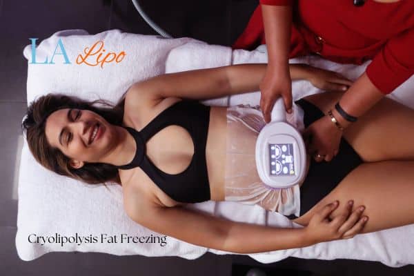 woman getting cryolipolysis Guildford