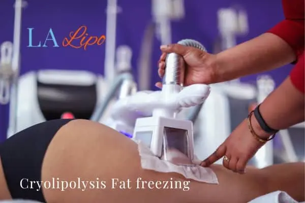 women getting fat freezing Guildford