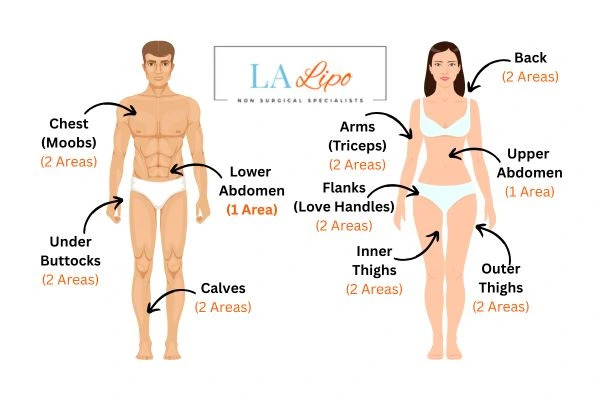 LA LIPO Cryolipolysis Areas Guildford