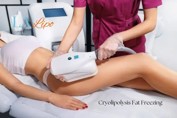 Woman receiving coolsculpting Guildford treatment on her thighs