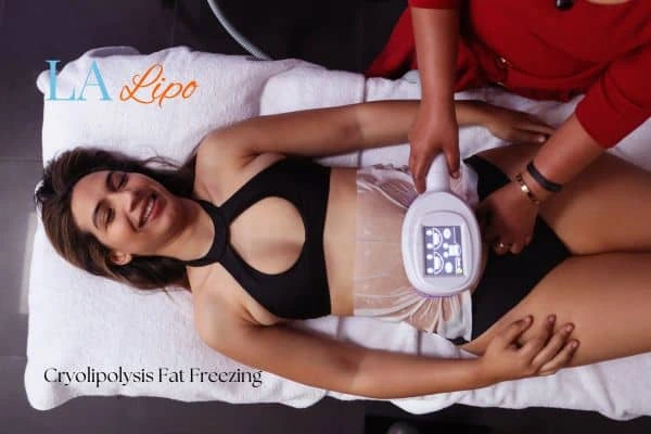 woman getting cryolipolysis Guildford