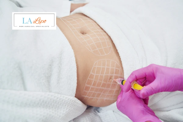 aqualyx fat dissolving injections Guildford