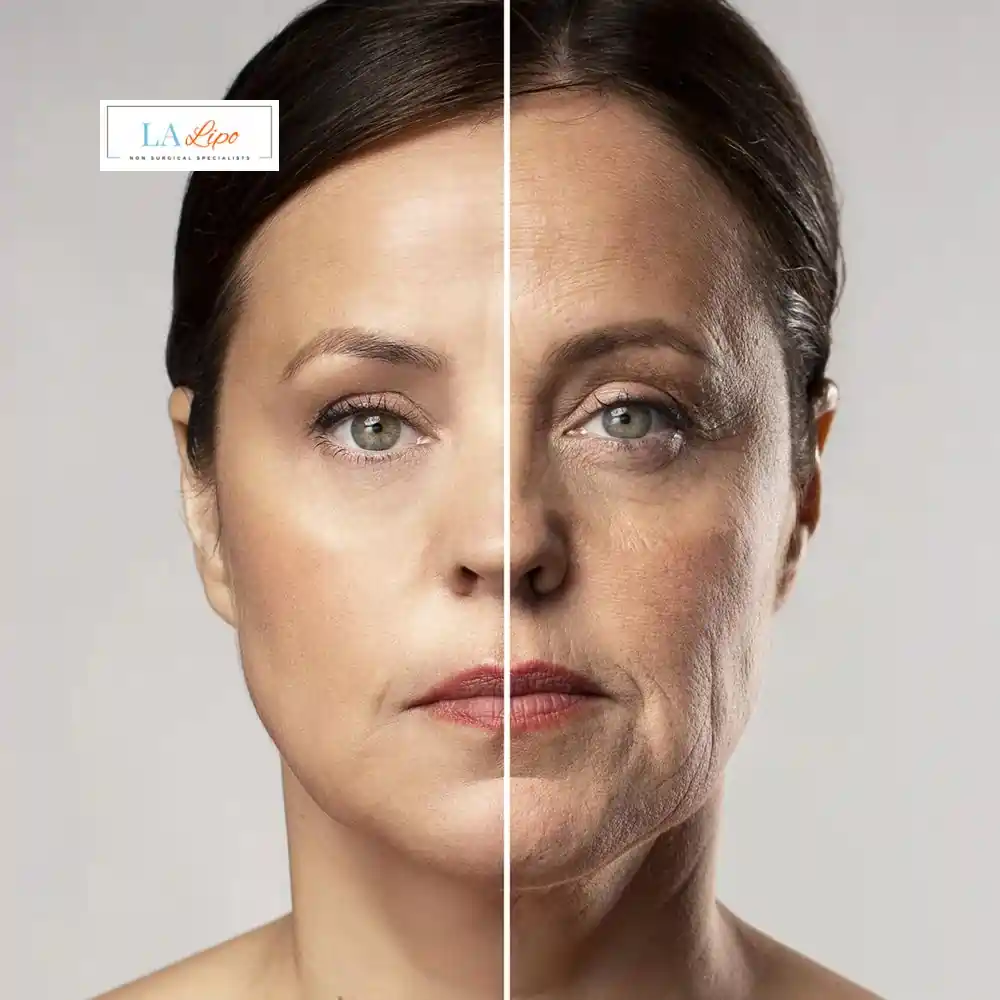 How Can You Tell If Non-Surgical Skin Tightening Is Right for You Guildford?