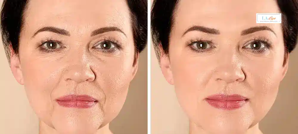 How Long Does It Take to See Results and How Long Do They Last Guildford?