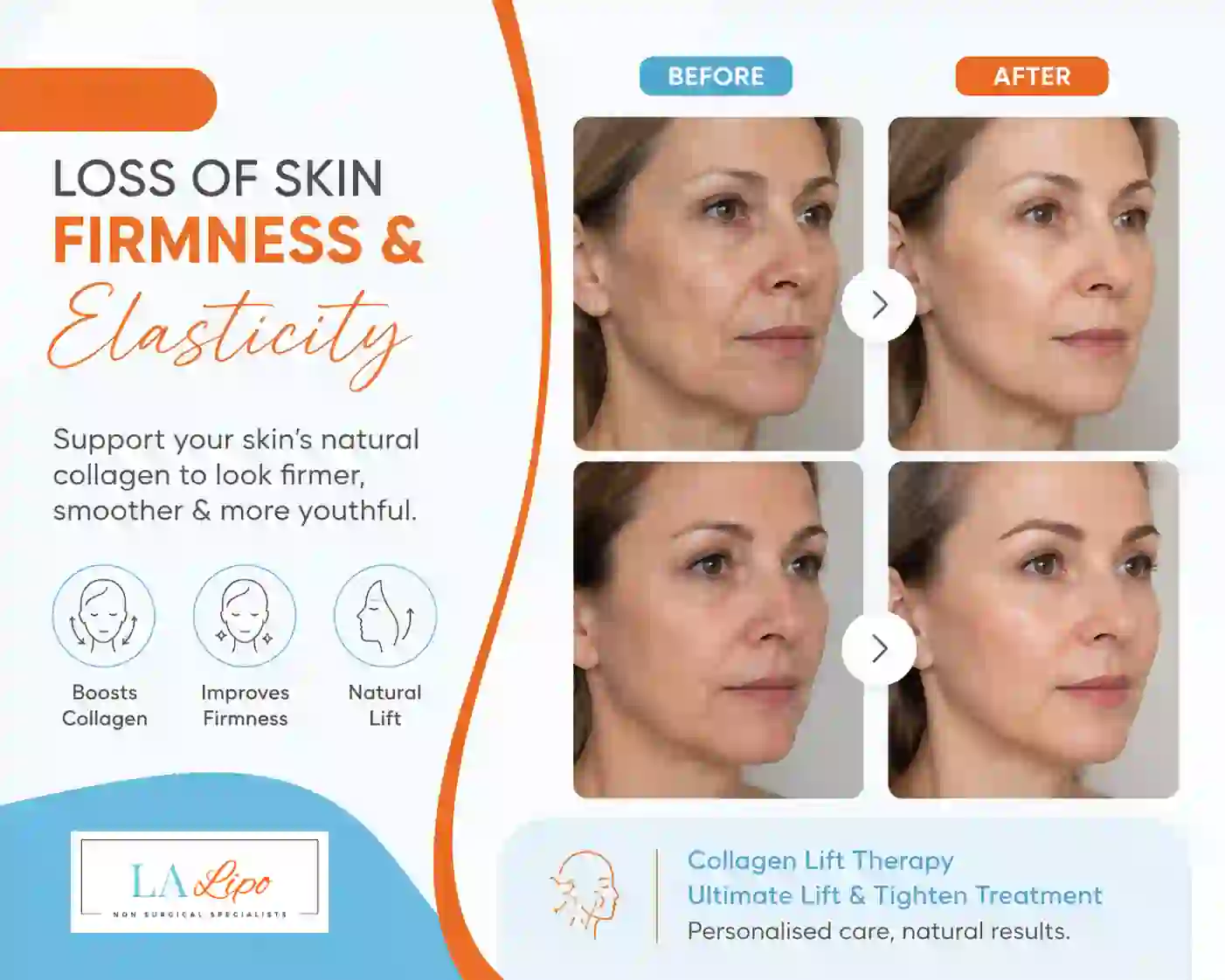 Sign #7: Loss of Skin Firmness and Elasticity Guildford
