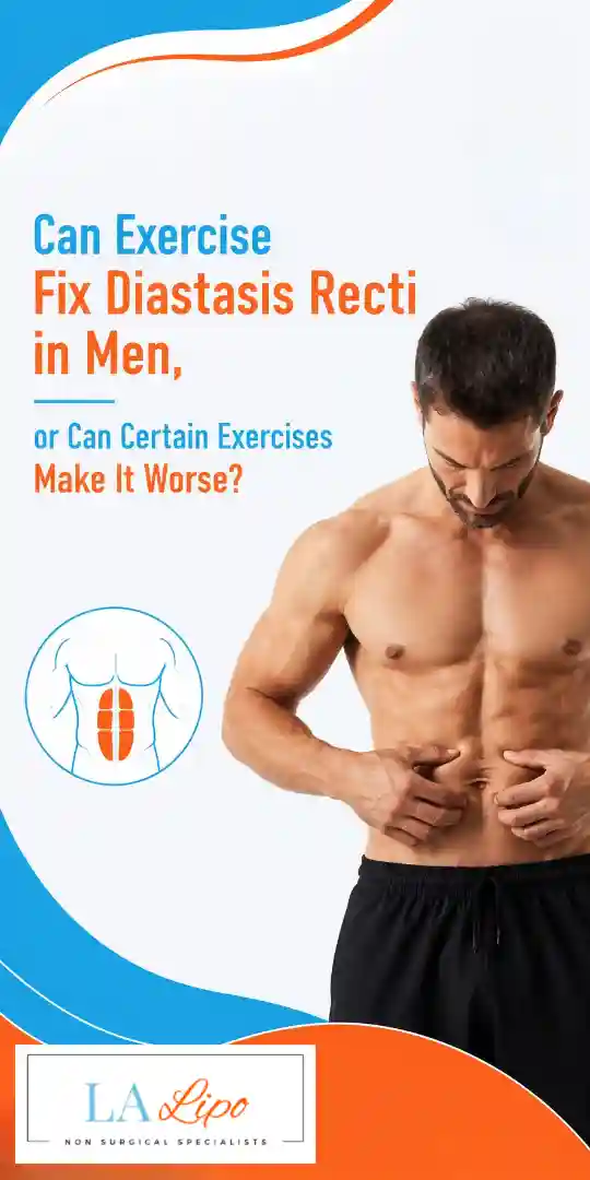 Can Exercise Fix Diastasis Recti in Men, or Can Certain Exercises Make It Worse Guildford?