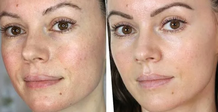 What happens during treatment Guildford