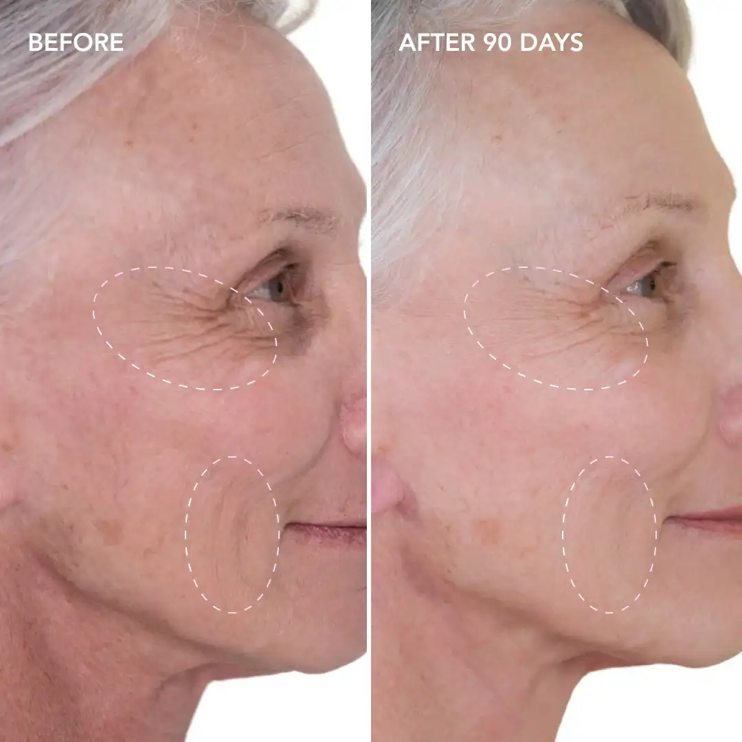 When will you see results Guildford
